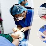 Cắt bọng mắt dưới ở đâu ĐẸP, UY TÍN số 1 Việt Nam hiện nay